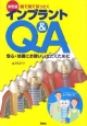 インプラントQ＆A　絵で見てなっとく＜決定版＞