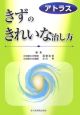 アトラス　きずのきれいな治し方