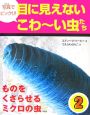 写真でビックリ！目に見えないこわ〜い虫たち　ものをくさらせるミクロの虫（2）