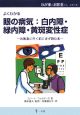 よくわかる　眼の病気：白内障・緑内障・黄斑変性症