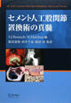 セメント人工股関節置換術の真髄