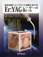Er：YAGレーザーの使い方　歯周治療・インプラント治療における