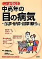 これで安心！中高年の目の病気