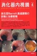 消化器内視鏡　26－4　2014April　表在型Barrett食道腺癌の診断と治療戦略