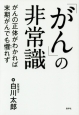 「がん」の非常識