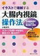 イラストで理解する　大腸内視鏡操作法