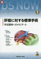 新DS　NOW　肝癌に対する標準手術（3）