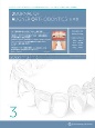 Journal　of　Aligner　Orthodontics　日本版　2022（3）