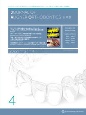 Journal　of　Aligner　Orthodontics　日本版　2022（4）